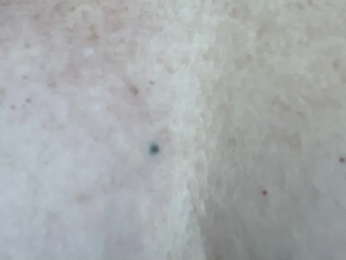 This Tattoo Helped Save My Life