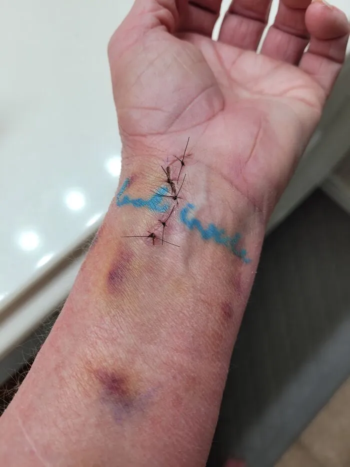 I Meant Look Inside For Strength, Not As Directions To The Surgeon. This Was #3 Surgery, Btw😣