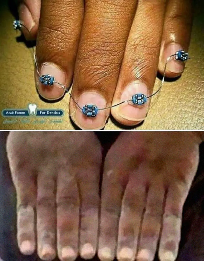 These Instagram Pages Are Dedicated To Bizarre Images That Are Not Pleasant To The Eye, Here Are 50 Of The Worst
