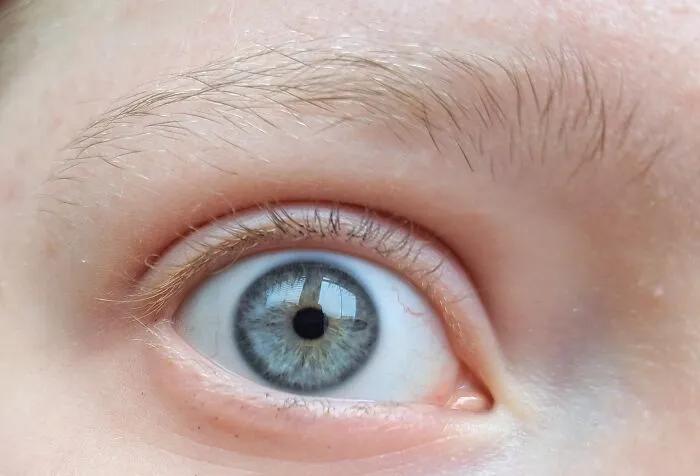 My Eye!