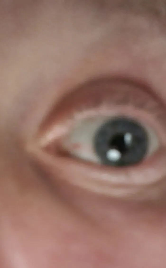 Eye Eye