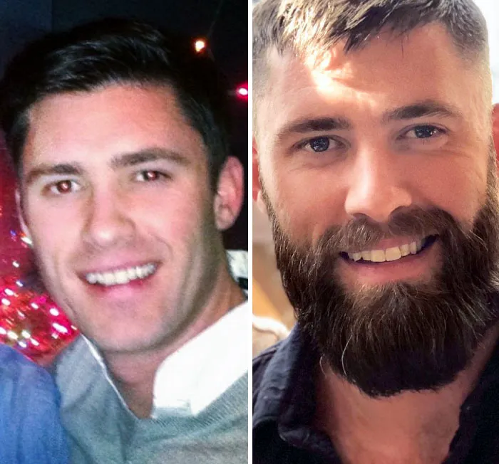 Beardless And With A Beard