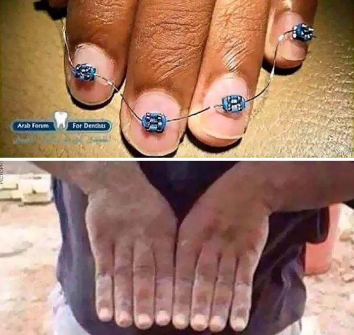 "Unhinged images: fingers with dental braces and dusty hands creating an unusual visual."