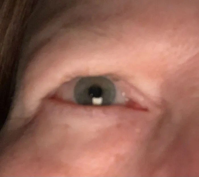 62 Year-Old Redhead Female