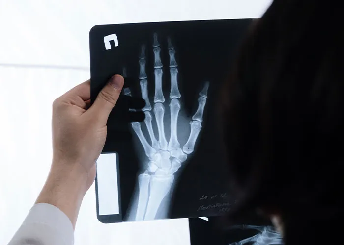 "My Feet Look More Like Paws Than Human Feet": 35 People Confess What Body Anomalies They Have