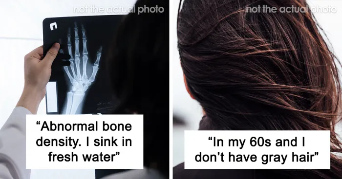 "My Feet Look More Like Paws Than Human Feet": 35 People Confess What Body Anomalies They Have
