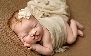 The Heart-Warming Story Of One Photograph: An Image Of A Baby With A Cleft Lip, Making Her Story Go Viral