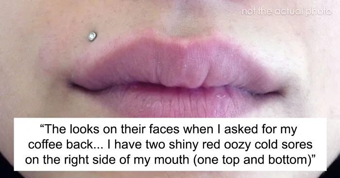 Teen Accepts A Dare To Drink From A Stranger’s Cup, Realizes She Has Herpes
