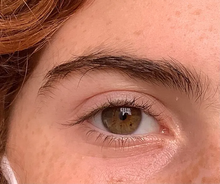 My Eye :p