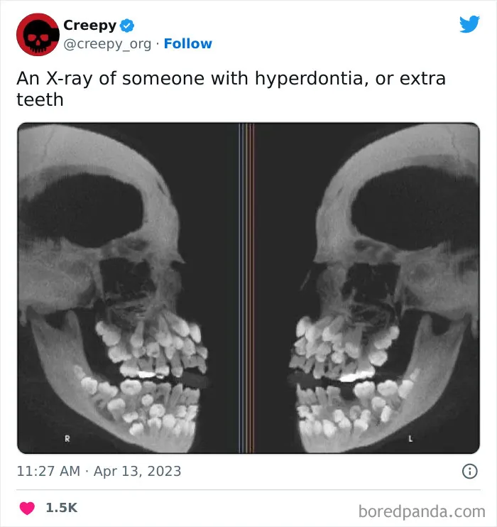 This Twitter Account Is About All Things Creepy, And Here Are 40 Of Their Most Chilling Posts