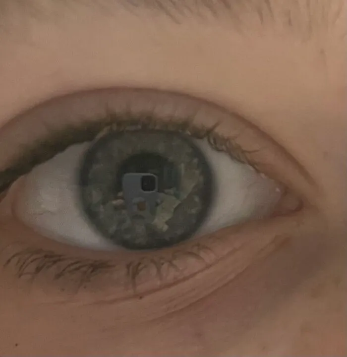 You Can See My Phone Case!