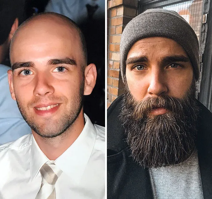 Before And After. What Do You Think About My Transformation?