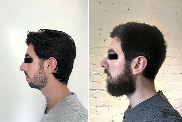 Still A Work In Progress But I Grew Myself A Chin
