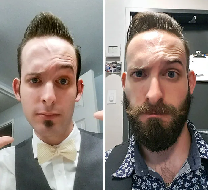 Before And After I Grew My Beard. Only Two Months Apart