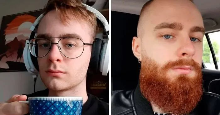 "Puberty Hit You Like A Truck": These 50 Pics Of Men Before And After Beards May Show Just What You’ve Been Missing In Your Life (New Pics)