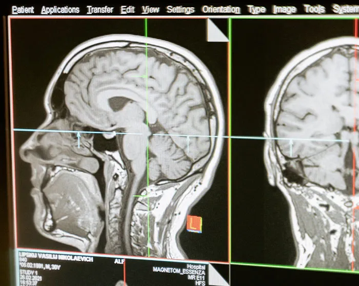 "Started Forgetting Words": 30 People Share Early Signs Of Cancer To Look Out For