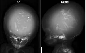 40 Bizarre And Inspiring Medical Cases That People Shared On This Online Community (New Pics)