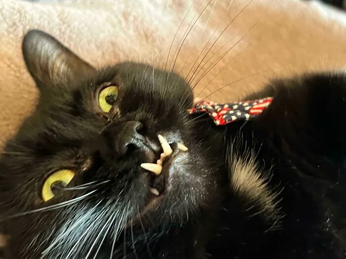 We Think He May Need Braces