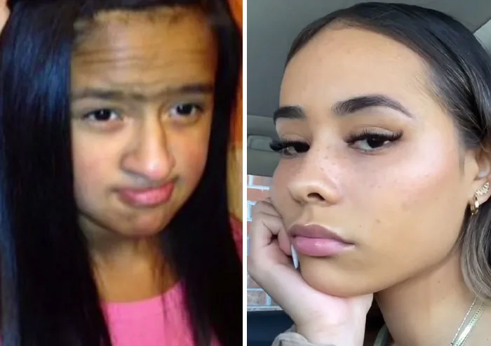People Who Were Picked On And Bullied For Their Looks Reveal Their Jaw-Dropping Transformations