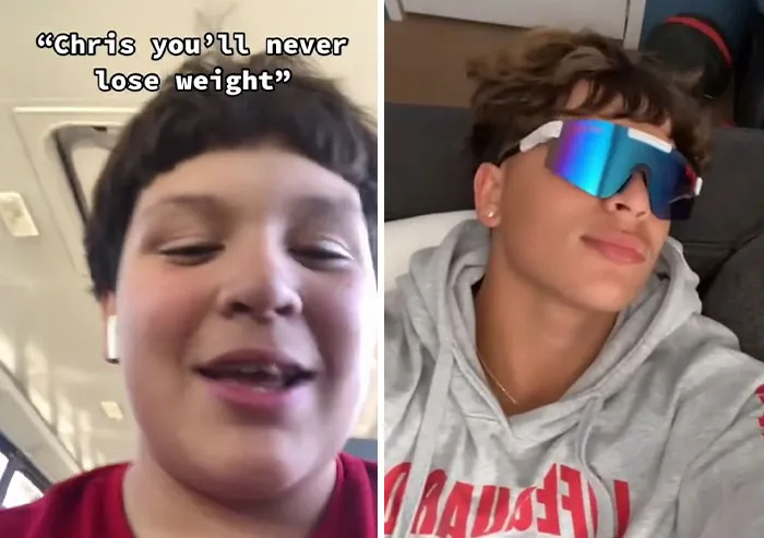 People Who Were Picked On And Bullied For Their Looks Reveal Their Jaw-Dropping Transformations