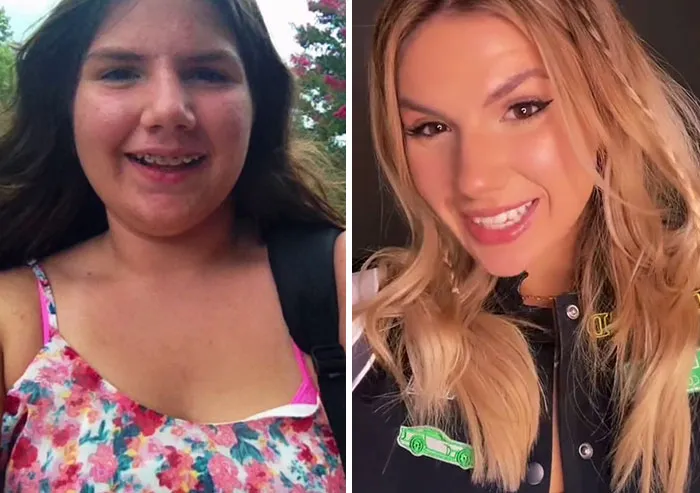 People Who Were Picked On And Bullied For Their Looks Reveal Their Jaw-Dropping Transformations