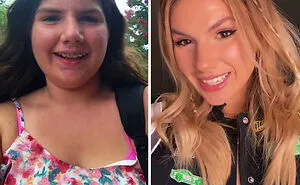 People Who Were Picked On And Bullied For Their Looks Reveal Their Jaw-Dropping Transformations