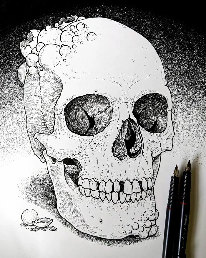 Cranial Osteocystis