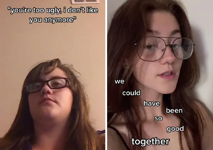 People Who Were Picked On And Bullied For Their Looks Reveal Their Jaw-Dropping Transformations