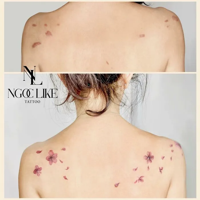 40 Personas que taparon sus cicatrices con tatuajes y quedó genial