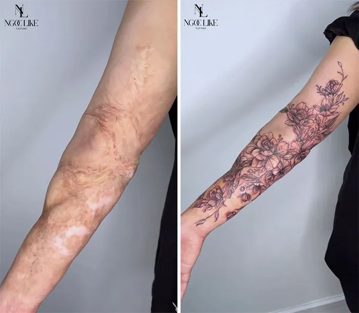 40 Personas que taparon sus cicatrices con tatuajes y quedó genial