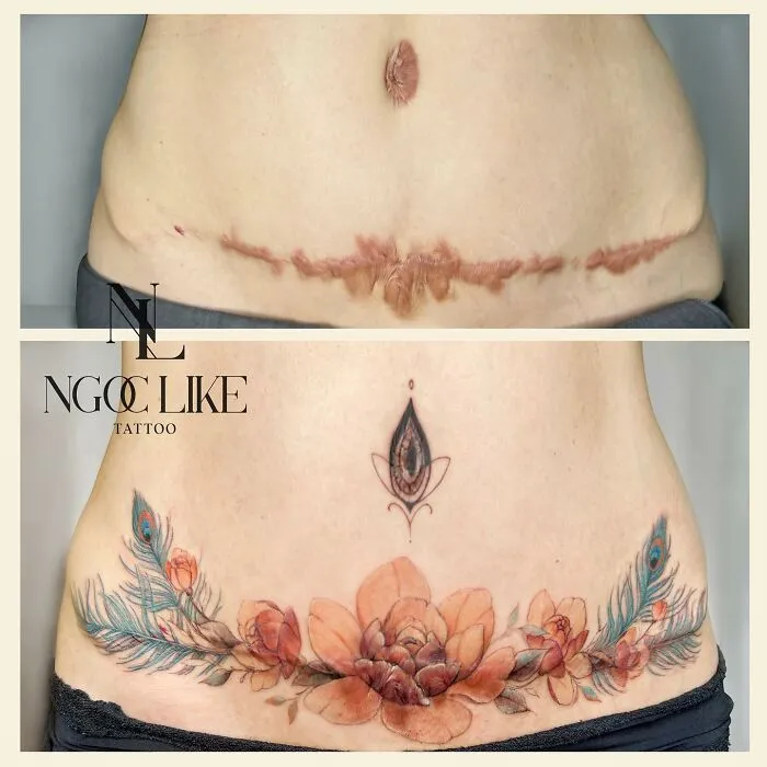 Tattoo artist covers a scar with vibrant floral design, showcasing skill in scar cover-up artistry.