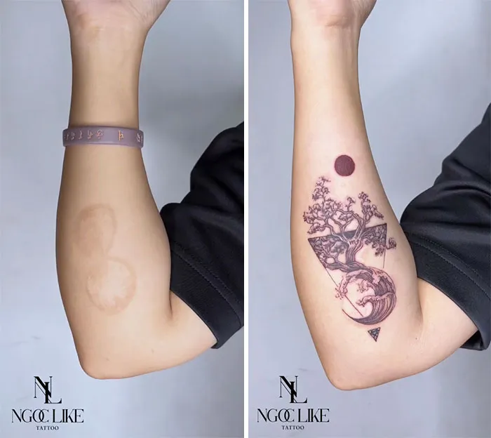 40 Personas que taparon sus cicatrices con tatuajes y quedó genial