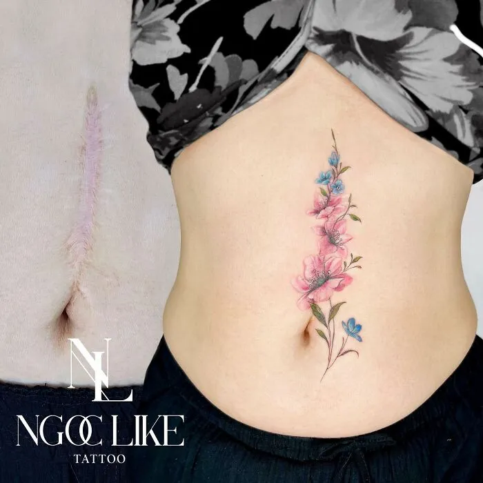 40 Personas que taparon sus cicatrices con tatuajes y quedó genial