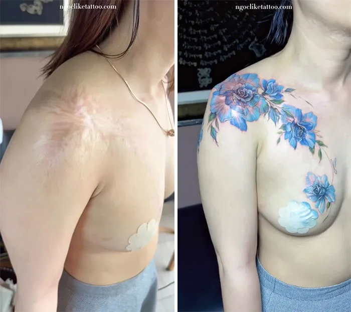 40 Personas que taparon sus cicatrices con tatuajes y quedó genial