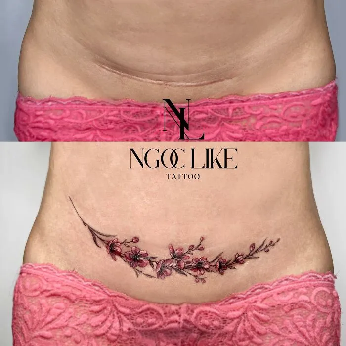 Beautiful floral tattoo expertly covering a scar on the lower abdomen, created by Ngoc Like Tattoo artist.