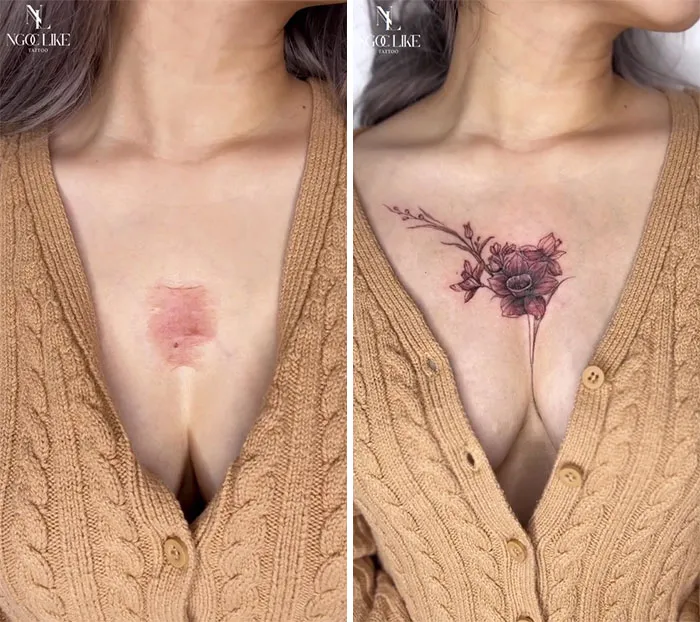 40 Personas que taparon sus cicatrices con tatuajes y quedó genial