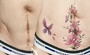 40 Times People Asked To Cover Up Their Scars And This Tattoo Artist Nailed It (New Pics)