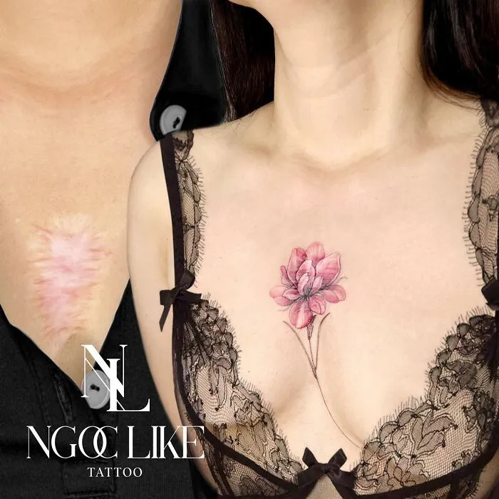 Tattoo artist covers a chest scar with a pink flower design tattoo in lace attire.