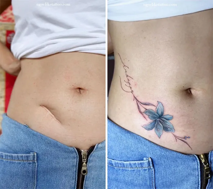 Scar cover-up tattoo of a blue flower created by a talented tattoo artist above jeans.