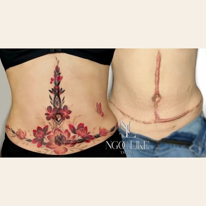 40 Personas que taparon sus cicatrices con tatuajes y quedó genial