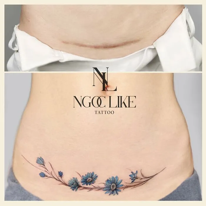Tattoo artist covers scar with floral design, showcasing impressive skill in scar camouflage.