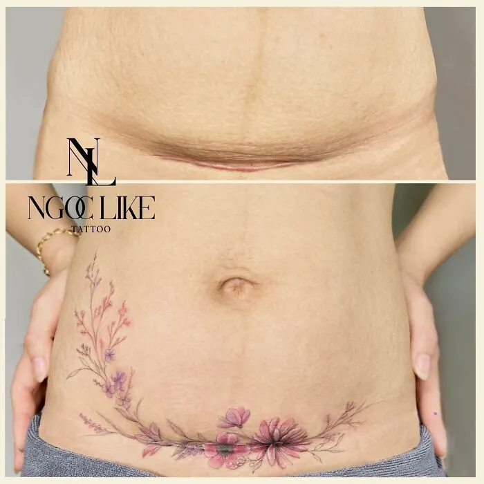 Tattoo artist covers abdominal scar with floral design, showcasing stunning transformation.