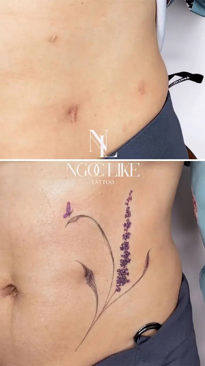 Tattoo covers scars with floral design; artist skillfully transforms the appearance.