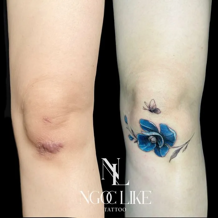 Tattoo artist covers elbow scar with a blue flower and butterfly design.