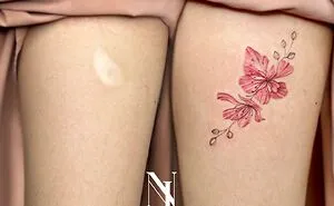 40 Times People Asked To Cover Up Their Scars And This Tattoo Artist Nailed It (New Pics)