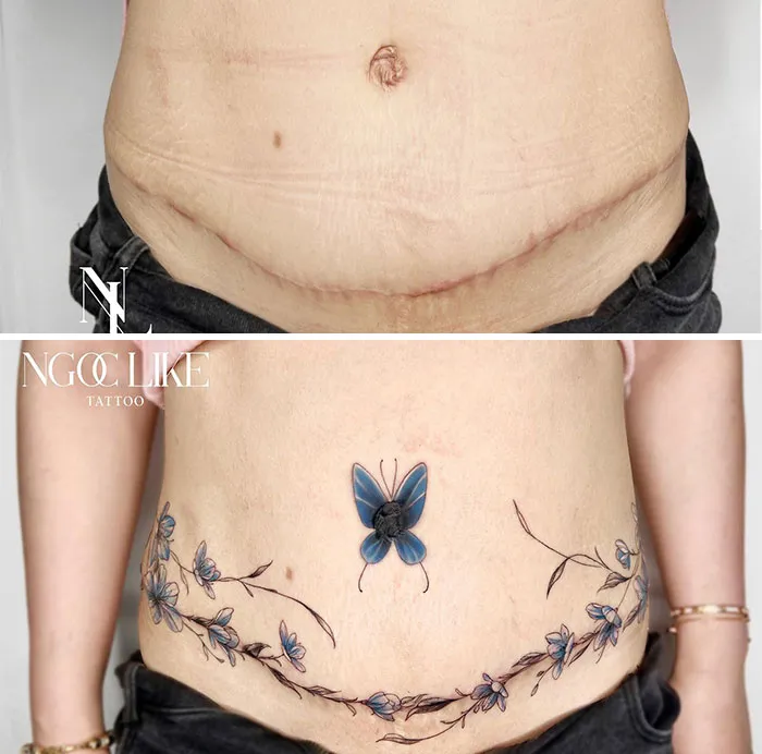 40 Personas que taparon sus cicatrices con tatuajes y quedó genial