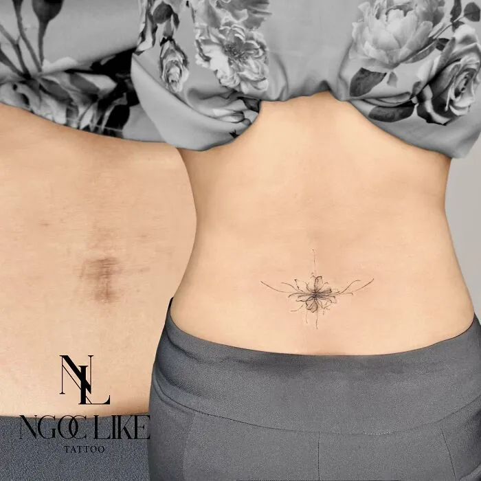 Tattoo artist transforms scar into floral design on lower back.