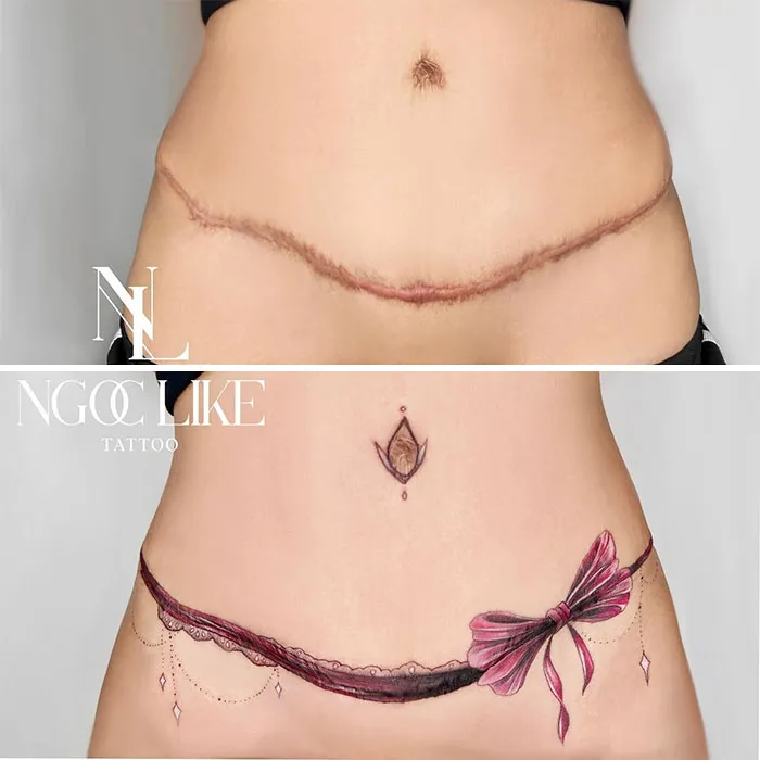 40 Personas que taparon sus cicatrices con tatuajes y quedó genial