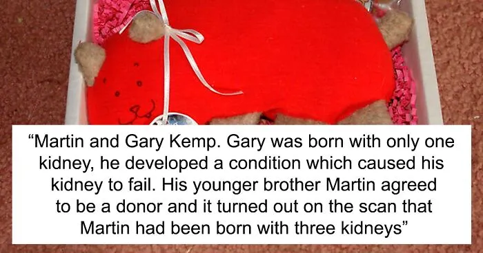 30 Facts That Sound Bizarre But Are Real, Shared By Folks In This Online Community