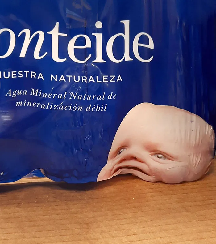 La ubicación de la cabeza de este bebé